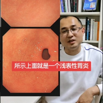 萎缩性胃炎